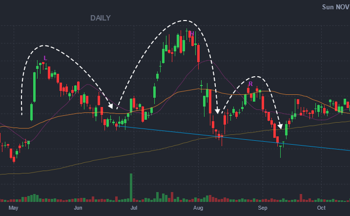 Head & Shoulders Pattern